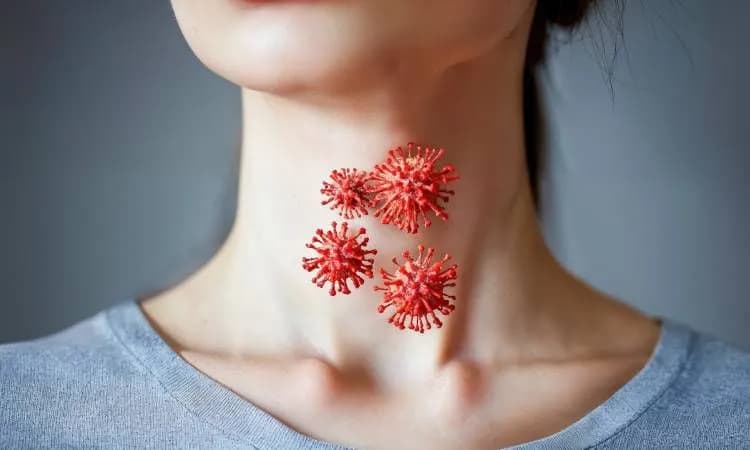 Skuteczne leki na anginę ropną bez recepty, które złagodzą ból gardła